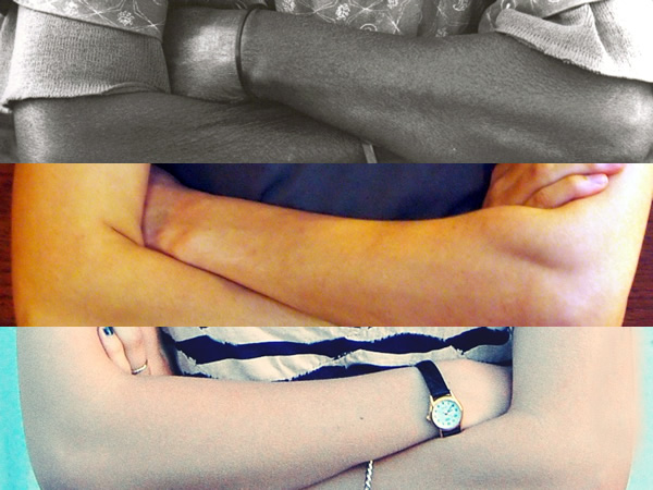 arms